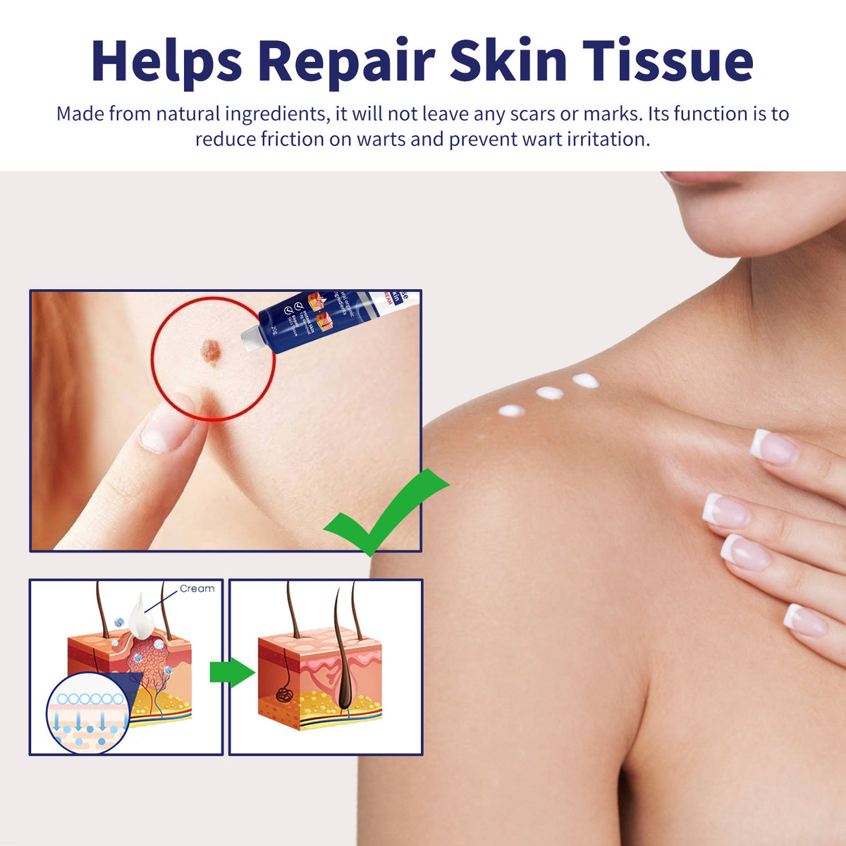 XIMONTH Wart Removal Cream for Skin Repair and Care