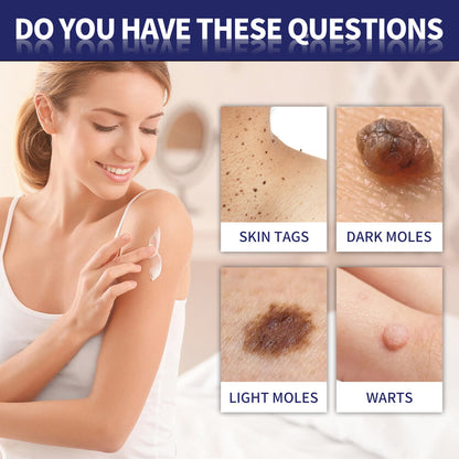 XIMONTH Wart Removal Cream for Skin Repair and Care