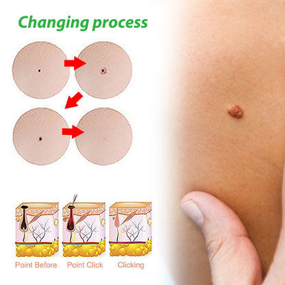 EELHOE Wart Removal Liquid for Skin Growths