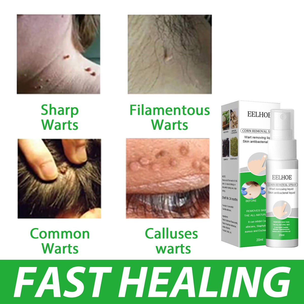 EELHOE Wart Removal Liquid for Skin Growths