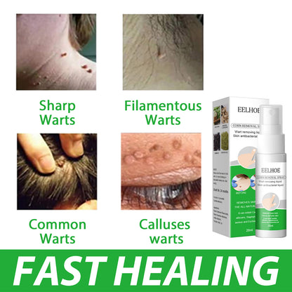 EELHOE Wart Removal Liquid for Skin Growths