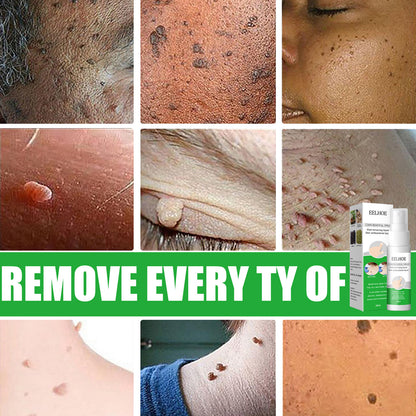 EELHOE Wart Removal Liquid for Skin Growths